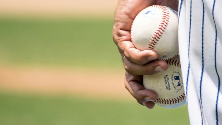A person wearing a striped jersey holding two baseballs with a baseball field in the background.